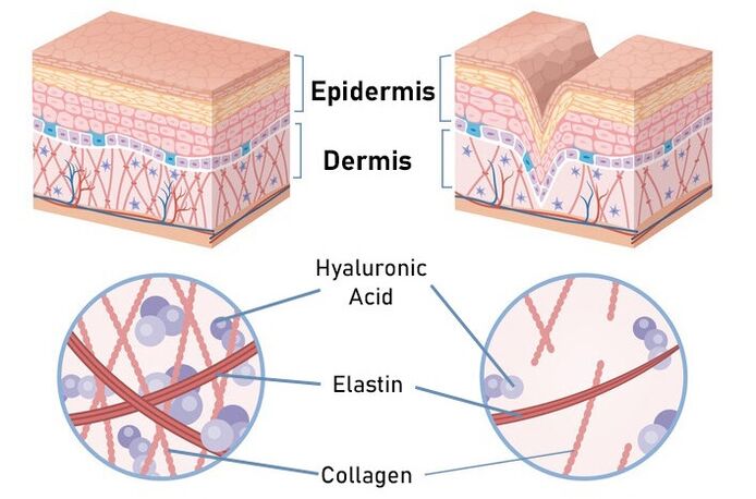 SIMLA 360 stimulates collagen synthesis