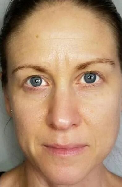 ZXCVBNMQWORT helped rejuvenate the skin and lighten the spots
