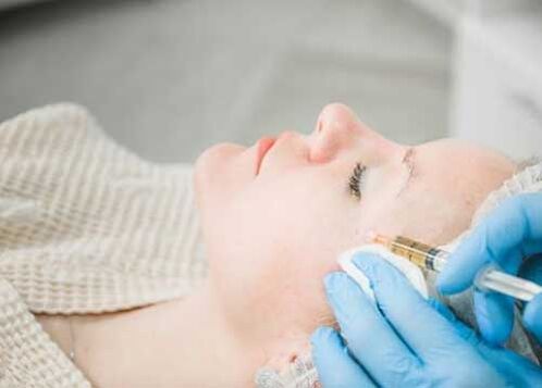 facial plasmolifting